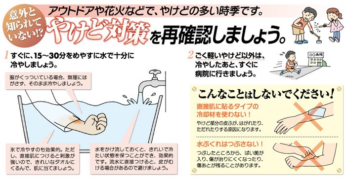 やけど対策を再確認しましょう