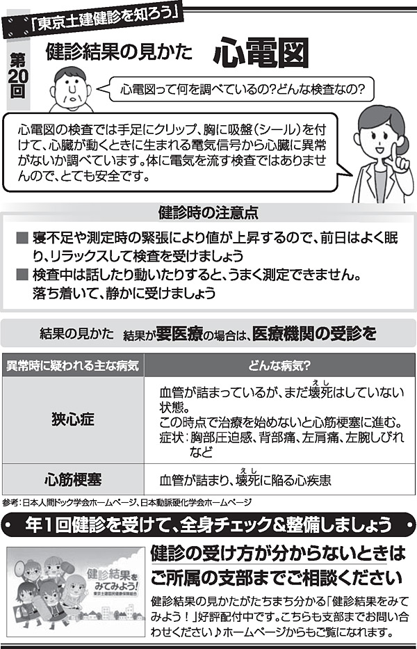 心電図